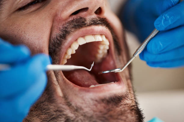 Best Emergency Treatment for Dental Infections or Abscesses in Wales, WI