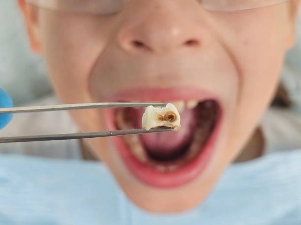 Best Emergency Gum Treatment in Wales, WI